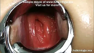 ગાયનેકોલોજિસ્ટ ટિંક ઇન્ડિયન સેક્સ વીડિયો